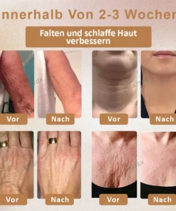 ATTDX Nano Hautstraffende Körpercreme Rolle