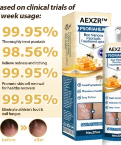 AEXZR™ PsoriaHeal Bee Venom Psoriasis Treatment Spray