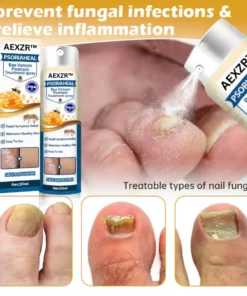 AEXZR™ PsoriaHeal Bee Venom Psoriasis Treatment Spray