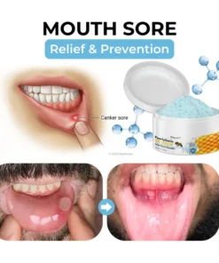 Biancat™ PearlySmile Bee Venom Oral Care Powder