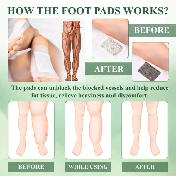 DetoxFlow™ SwellRelief Lymphatic Foot Pads