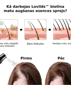 LOVILDS™ Biotīna matu augšanas serums