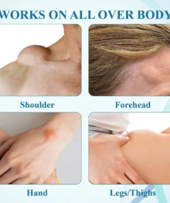 Lovilds™ LumpsClear Lymph Say Goodbye to Lipomas and Swelling