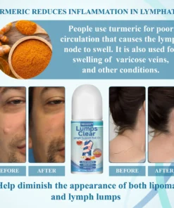 Lovilds™ LumpsClear Lymph Say Goodbye to Lipomas and Swelling