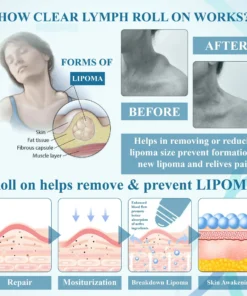 Lovilds™ LumpsClear Lymph Say Goodbye to Lipomas and Swelling