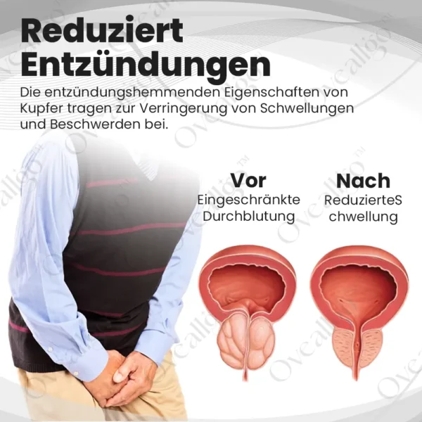 Oveallgo™ KupferMag Wellness-Therapie-Ring