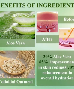 RelievaDerm™ Aloe SkinTherapy HydratingGel