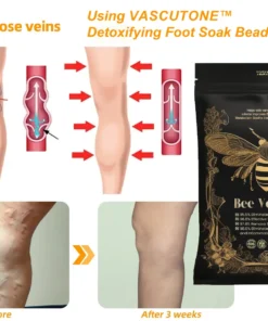 VascuTone™ Bee venom lymphatic detoxification slimming foot bath beads