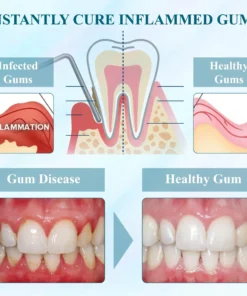 WhiteningSmile™ Coconut Oil GumGuard Mouthwash