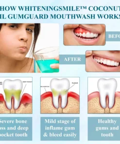 WhiteningSmile™ Coconut Oil GumGuard Mouthwash