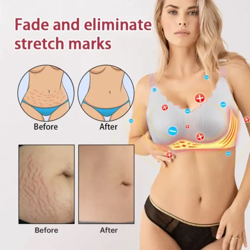 𝐃𝐞𝐭𝐨𝐱 Shaping Bra - All-Day Tender Care