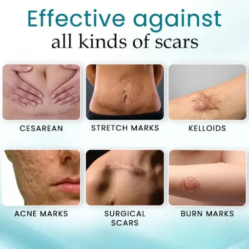 AEXZR™ Advance Scar Care Formulah - Image 2