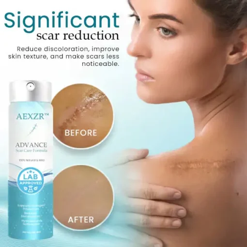 AEXZR™ Advance Scar Care Formulah - Image 5