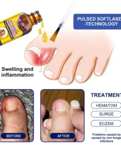 AEXZR™ Bee Venom Nail Fungus Treatment Solution