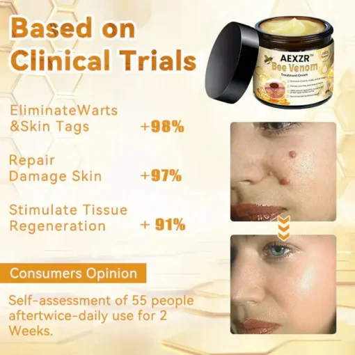 AEXZR™ Bee Venom Skin Treatment Cream - Image 8