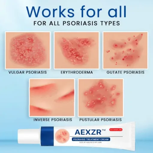 AEXZR™ Psoriasis Treatment Cream - Image 4