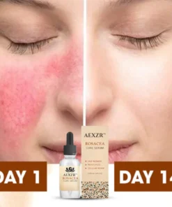 AEXZR™ Rosacea Cure Serum