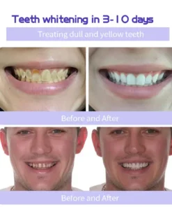 AEXZR™ Teeth Restoration Mineral Powder