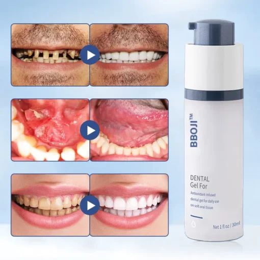 BBOJI™ Teeth Whitening Repair Regrowth Dental Gel - Image 4