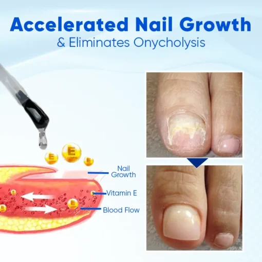 Biancat™ OnyxoGuard Nail Growth and Repair Serum - Image 3