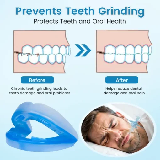 Ceoerty™ Anti-Snoring & Anti-Grinding Teeth Protector - Image 5