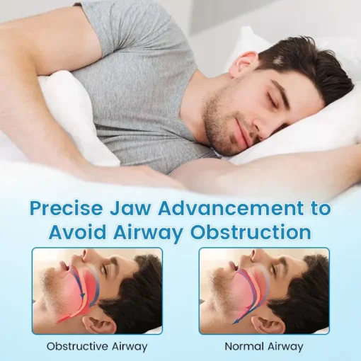 Ceoerty™ Anti-Snoring & Anti-Grinding Teeth Protector - Image 6