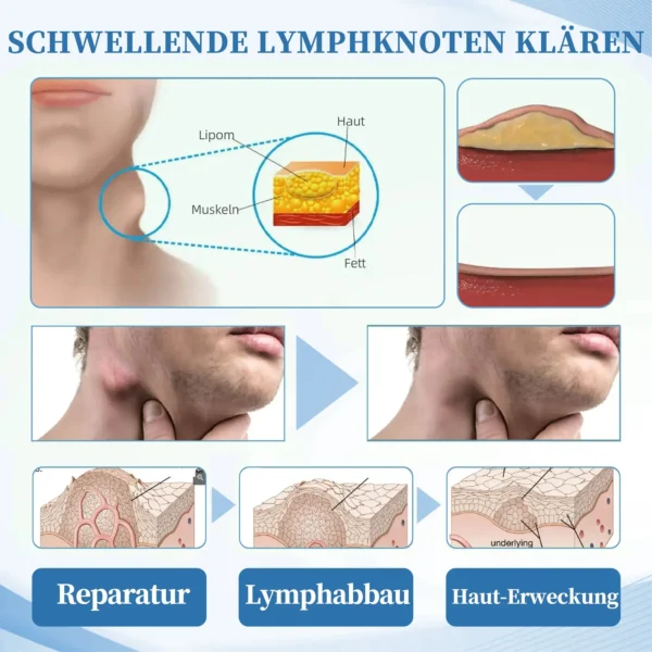 DOCTIA™ Tragbarer Multifunktionaler Naseninhalationsstift