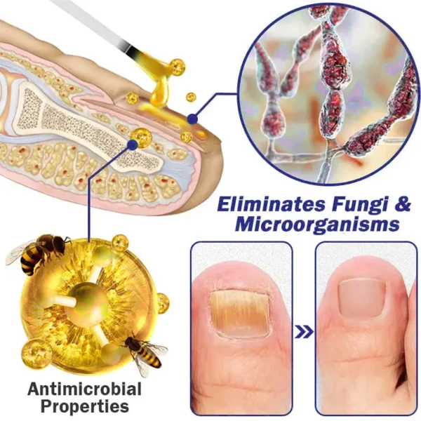 FURZERO™ Multi-Purpose Nail Repair