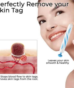 Fivfivgo™ At-home Skin Tag Removal Pen