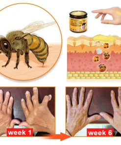 Furzero™ Bee Venom & Turmeric Joint and Bone Pain Relief Cream