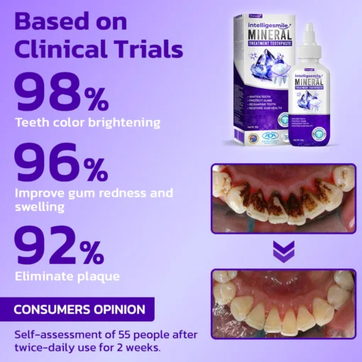 Furzero™ IntelligeSmile Mineral Treatment Toothpaste - Image 5