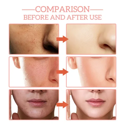 HZA™ 5-in-1 facial care - Image 5