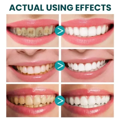 LIMETOW™ Instant Teeth Whitening Paint - Image 5