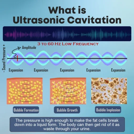 Miniyou Ultrasonic Detox Bracelets - Image 4