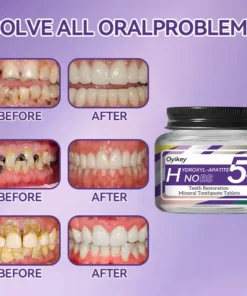 Oyikey™ Teeth Restoration Mineral Toothpaste Tablets