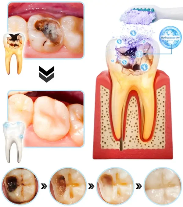 Oyikey™ Teeth Restoration Poudre Minérale