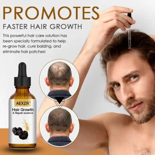 AEXZR™ Hair Growth & Repair Essence - Image 3